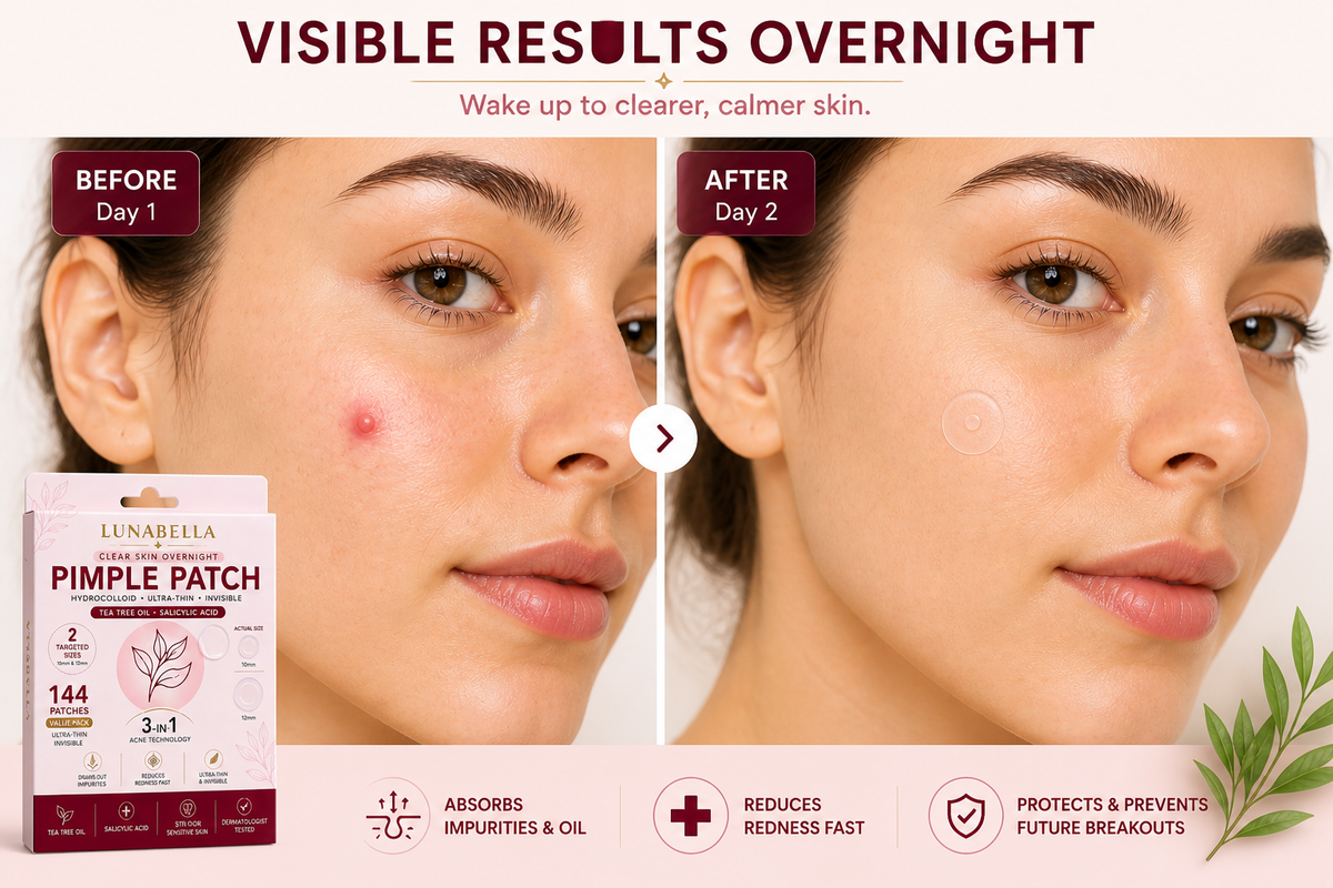 Pimple Patches - 3-in-1 Acne Blemish Treatment